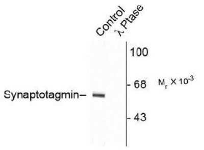 Western Blot: Synaptotagmin 1 [p Thr202] Antibody [NB300-235] - Western blot of rat cortex lysate showing specific immunolabeling of the ~60k - ~62k synaptotagmin phosphorylated at Thr202 (Control). The phosphospecificity of this labeling is shown in the second lane (lambda-phosphatase). The blot is identical to the control except that it was incubated (1200 units for 30 min) before being exposed to the Thr202 synaptotagmin antibody. The immunolabeling is completely eliminated by treatment with lambda-phosphatase.